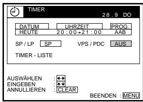 SONY SLV-SF990E - Drucken Sie  TIMER. - 15