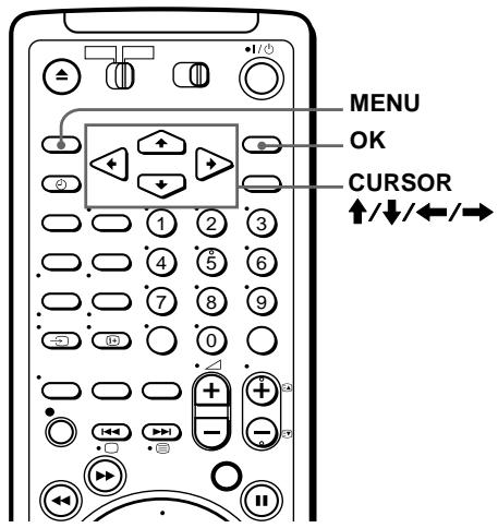 SONY SLV-SF990E - Vorbereitungen... - 1