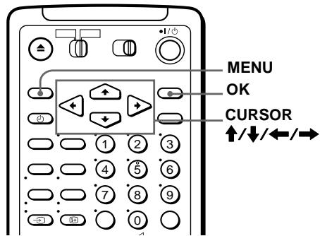 SONY SLV-SF990E - Schritt 6 :Einstellen der Uhr - 1