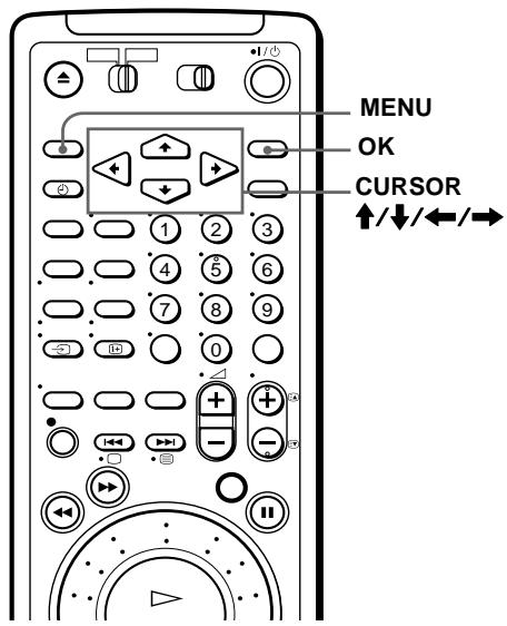 SONY SLV-SF990G - Before you start... - 1