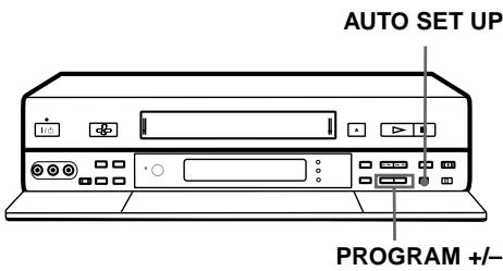 SONY SLV-SF990G - Before you start ... - 1