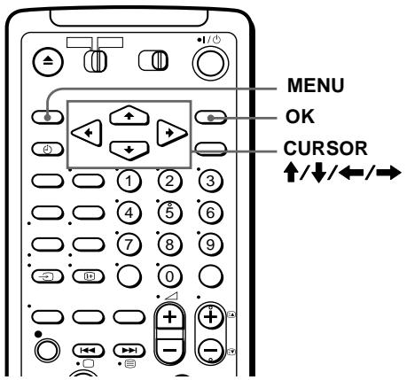 SONY SLV-SF990G - Before you start... - 1