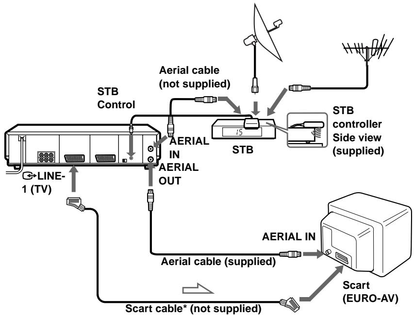 SONY SLV-SF990G - If your STB does not have a Scart (EURO-AV) connector - 1