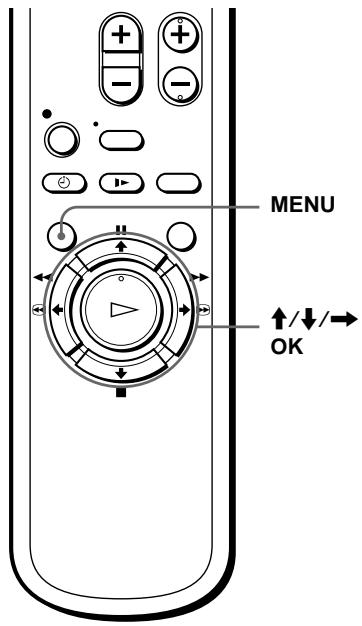 SONY SLV-SX100K - Before you start... - 1