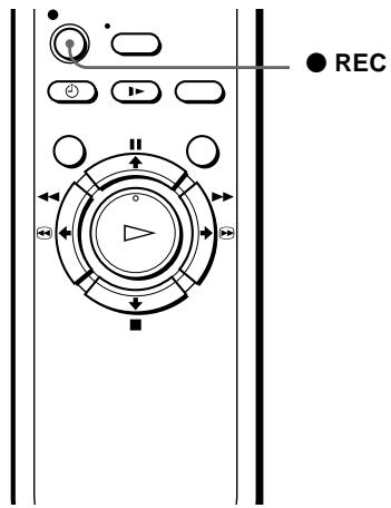 SONY SLV-SX100K - Setting the recording duration time - 1