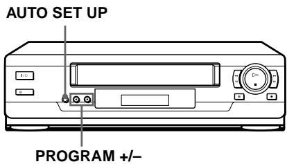 SONY SLV-SX100K - Step 5 : Setting up the VCR with the Auto Set Up function - 1