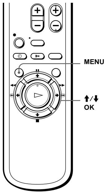 SONY SLV-SX100K - Before you start... - 1