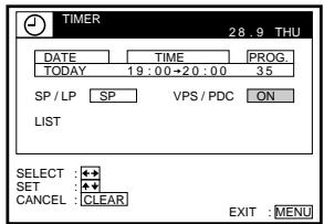 SONY SLV-SX100K - Before you start... - 15