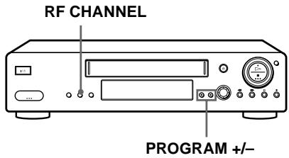 SONY SLV-X9G - If your TV has a Scart (EURO-AV) connector - 1