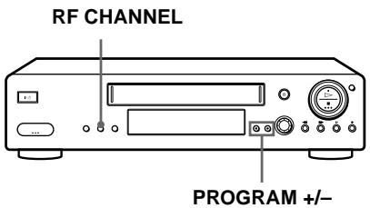 SONY SLV-X9G - If your TV does not have a Scart (EURO-AV) connector - 1