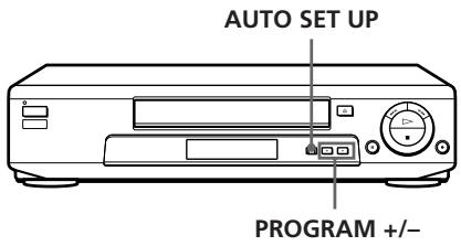 SONY SLV-E735VC - Einstellen des Videorecorders mit der automatischen Einstellfunktion - 1