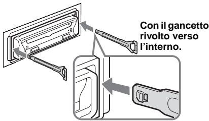 SONY DVX-11B - Rimuovere l'apparecchio. - 1