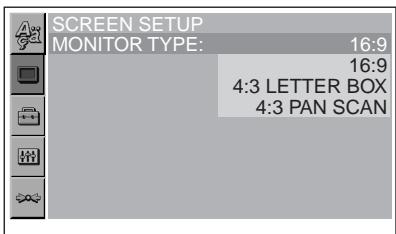 SONY DVX-11B - Premere (SETUP). - 2