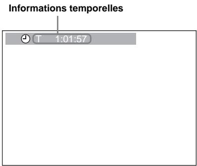 SONY DVX-11B - En cours de la lecture, appuyez sur DISPLAY. - 1
