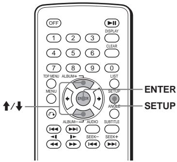 SONY DVX-11B - PVD VCD - 1