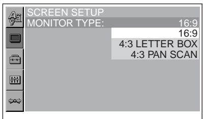 SONY DVX-11B - Premere (SETUP). - 3