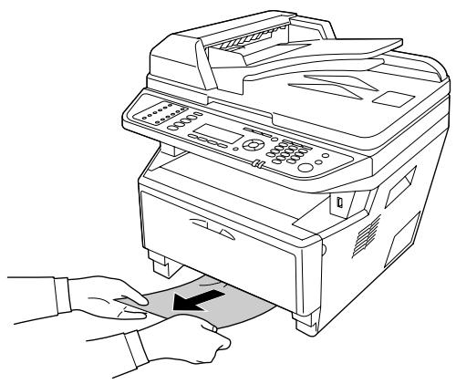 EPSON ACULASER MX20DNF - Bourrage papier au niveau du bac à papier standard - 2