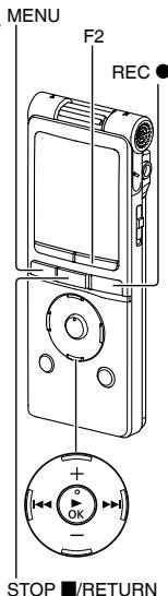 PANASONIC RR-XS420E - Self timer - 2