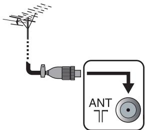 ANT 7T