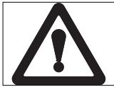 HUSQVARNA ROYAL 43 S - Explanation of Symbols on your Husqvarna Royal 43, 43S and 43SE - 1