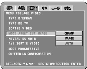 DENON DVD-2200 - Remarque: - 1