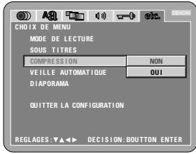 DENON DVD-A1 - OUI - 1