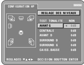 DENON DVD-A1 - NON - 1