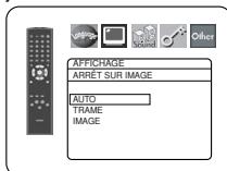 DENON DVD-557 - REMARQUE : - 1