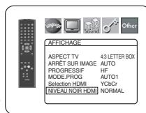 DENON DVD-557 - REMARQUE : - 5