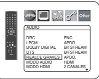 DENON DVD-757 - MODO AUDIO (Predeterminado: HDMI) - 7