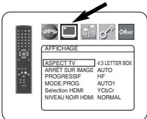 DENON DVD-757 - ASPECT TV (Défaut: 4:3 LETTER BOX) QUICK - 1
