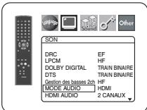 DENON DVD-757 - Réglage des enceintes pour AUDIO ANALOGIQUE - 1