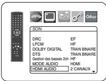 DENON DVD-757 - Réglage des enceintes pour AUDIO ANALOGIQUE - 2