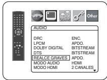 DENON DVD-757 - MODO AUDIO (Predeterminado: HDMI) - 6
