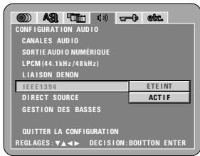 DENON DVD-A11 - 2e - 1