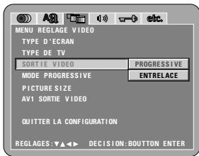 DENON DVD-A11 - REMARQUE: - 1