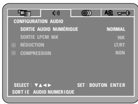 DENON DVD-M330 - Remarque : - 1