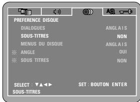 DENON DVD-M330 - Autre - 1