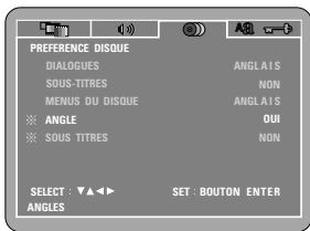 DENON DVD-M330 - Autre - 1