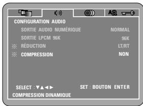 DENON DVD-M330 - Stéréo - 1