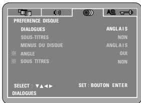 DENON DVD-M330 - Remarque : - 1