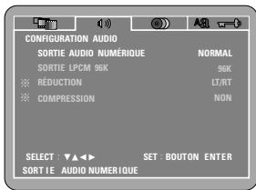 DENON DVD-M330 - Lorsque "Configuration audio" est sélectionnée - 1