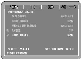 DENON DVD-M330 - Oui (réglage usine par défaut) - 1