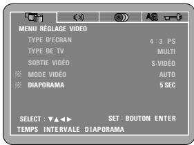 DENON DVD-M330 - Video - 1