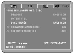 DENON DVD-M330 - SONSTIGE - 1