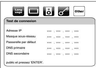DENON DBP-2010 - Test de connexion - 1