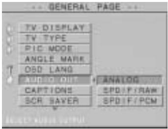 BLAUPUNKT DVD-ME2 - 6) SORTIE AUDIO - 1