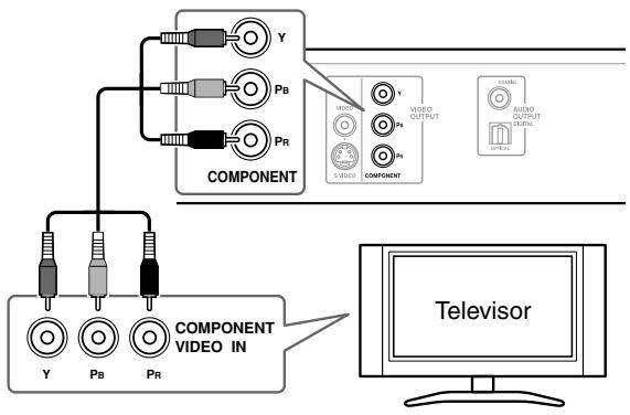 ONKYO DV-SP504E - Utilizar video compuesto - 1