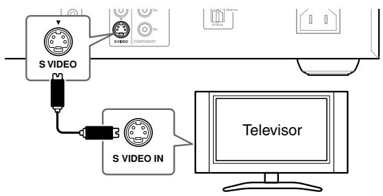 ONKYO DV-SP504E - Utilizar S-Video - 1