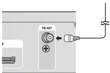 FM ANT